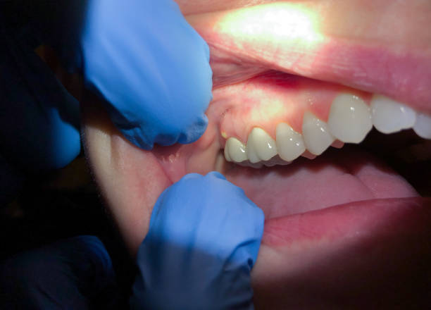 Best Emergency Treatment for Toothache in Bayboro, NC